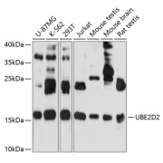 Western blot analysis of extracts of various cell lines using UBE2D2 Antibody (1/1000 dilution).