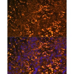 UDP-Glucuronosyltransferase 1-1 (UGT1A1) Antibody