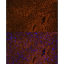 UDP-Glucuronosyltransferase 1-1 (UGT1A1) Antibody