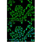 Immunofluorescence analysis of U2OS cells using UGT1A1 Antibody