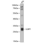 Western blot analysis of extracts of Raji cells using ULBP1 Antibody (1/1000 dilution).