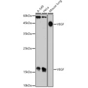 Western blot analysis of extracts of various cell lines using VEGF Antibody (1/1000 dilution).