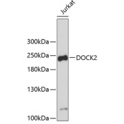 Western blot analysis of extracts of Jurkat cells using DOCK2 Antibody.