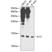 Western blot analysis of extracts of various cell lines using IL13 Antibody (1/1000 dilution).