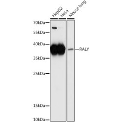 RALY Heterogeneous Nuclear Ribonucleoprotein (RALY) Antibody