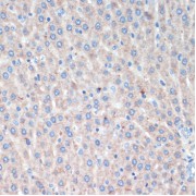 Immunohistochemistry of paraffin-embedded Rat liver using LRRK2 Antibody (1/200 dilution, 40x lens).