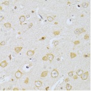 Immunohistochemistry of paraffin-embedded Rat brain using CHRNA7 Antibody (1/100 dilution, 40x lens).