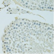 Immunohistochemistry of paraffin-embedded Rat testis using BRD3 Antibody (1/100 dilution, 40x lens).