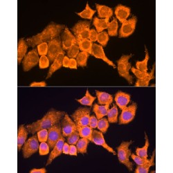 Ribosomal Protein L23 (RPL23) Antibody