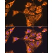 Immunofluorescence analysis of C6 cells using RPL23 Antibody (1/100 dilution). Blue: DAPI for nuclear staining.