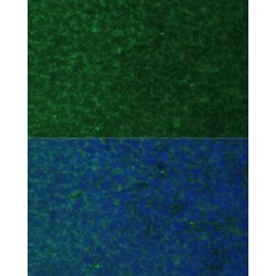 Phorbol-12-Myristate-13-Acetate-Induced Protein 1 (PMAIP1) Antibody