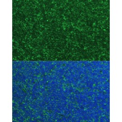 Phorbol-12-Myristate-13-Acetate-Induced Protein 1 (PMAIP1) Antibody