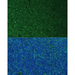 Phorbol-12-Myristate-13-Acetate-Induced Protein 1 (PMAIP1) Antibody