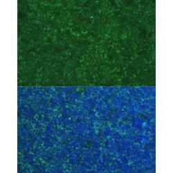 Phorbol-12-Myristate-13-Acetate-Induced Protein 1 (PMAIP1) Antibody