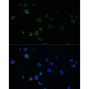 Immunofluorescence analysis of Jurkat cells using PMAIP1 Antibody (1/100 dilution). Blue: DAPI for nuclear staining.