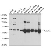 Western blot analysis of extracts of various cell lines using BCKDHA Antibody (1/1000 dilution).