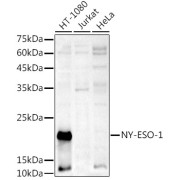 Western blot analysis of extracts of various cell lines using NY-ESO-1 Antibody (1/1000 dilution).