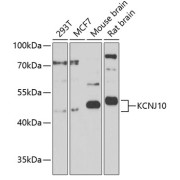 Western blot analysis of extracts of various cell lines using KCNJ10 Antibody (1/1000 dilution).