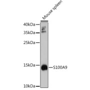 Western blot analysis of extracts of Mouse spleen using S100A9 Antibody (1/1000 dilution).