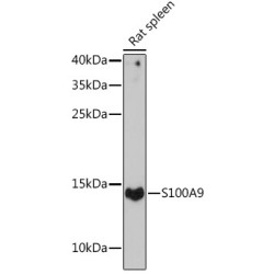 Protein S100-A9 / CAGB (S100A9) Antibody