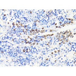 Protein S100-A9 / CAGB (S100A9) Antibody