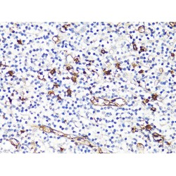 Protein S100-A9 / CAGB (S100A9) Antibody