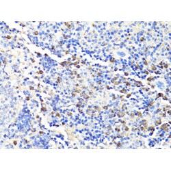 Protein S100-A9 / CAGB (S100A9) Antibody