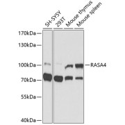 Western blot analysis of extracts of various cell lines using RASA4 Antibody (1/1000 dilution).