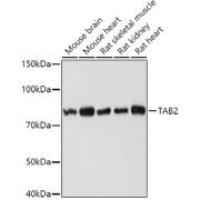 Western blot analysis of extracts of various cell lines using TAB2 Antibody (1/1000 dilution).