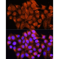 ATP Synthase Subunit Delta, Mitochondrial (ATP5F1D) Antibody