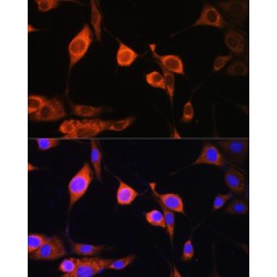 ATP Synthase Subunit Delta, Mitochondrial (ATP5F1D) Antibody