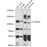 Western blot analysis of extracts of various cell lines using EPHA7 Antibody (1/1000 dilution).