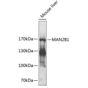 Western blot analysis of extracts of mouse liver using MAN2B1 Antibody (1/1000 dilution).