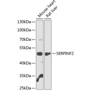 Western blot analysis of extracts of various cell lines using SERPINF2 Antibody (1/1000 dilution).