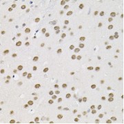 Immunohistochemistry of paraffin-embedded Mouse brain using BAF60a Antibody (1/100 dilution, 40x lens).