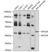 Western blot analysis of extracts of various cell lines using MYLK4 Antibody (1/1000 dilution).