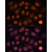 Immunofluorescence analysis of HeLa cells using KLF6 Antibody (1/100 dilution). Blue: DAPI for nuclear staining.