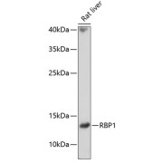 Western blot analysis of extracts of Rat liver using RBP1 Antibody (1/1000 dilution).