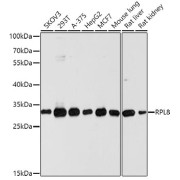 Western blot analysis of extracts of various cell lines using RPL8 Antibody (1/1000 dilution).