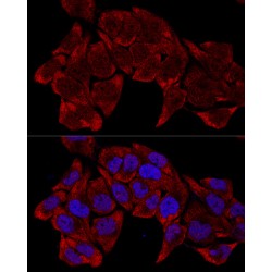 Ribosomal Protein L8 (RPL8) Antibody