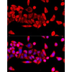 Ribosomal Protein L8 (RPL8) Antibody