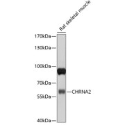 Western blot analysis of extracts of rat skeletal muscle using CHRNA2 Antibody (1/1000 dilution).