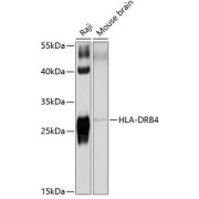 Western blot analysis of extracts of various cell lines using HLA-DRB4 Antibody (1/1000 dilution).