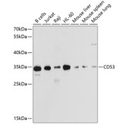 Western blot analysis of extracts of various cell lines using CD53 Antibody (1/1000 dilution).