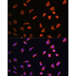 ADP Ribosyltransferase 1 (ART1) Antibody