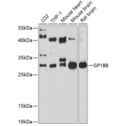 Western blot analysis of extracts of various cell lines using GP1BB Antibody (1/1000 dilution).