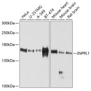 Western blot analysis of extracts of various cell lines using INPPL1 Antibody (1/1000 dilution).