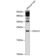 Western blot analysis of extracts of mouse liver using SSSCA1 Antibody (1/1000 dilution).