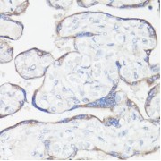 Immunohistochemistry of paraffin-embedded Human placenta using CLUH Antibody (1/100 dilution, 40x lens).