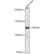 Western blot analysis of extracts of Rat brain using TRPM4 Antibody (1/1000 dilution).